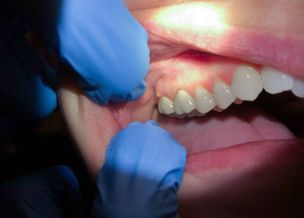 Best Urgent Tooth Repair  in De Queen, AR